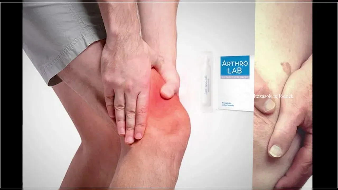 Artroflex : ku te blej ne shqiperi, ne farmaci?