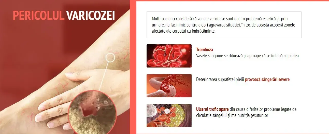 Varcosin : përbërja vetëm përbërës natyralë.
